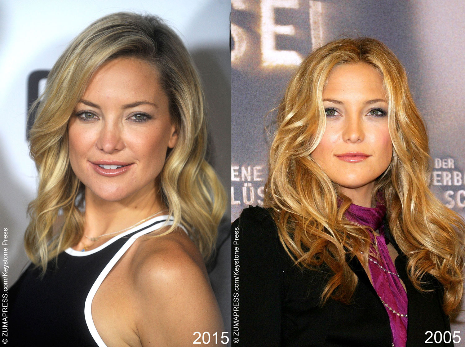 Kate Hudson seems to have found a way to stop aging. Since her acting career to a giant leap forward with Almost Famous, Kate has barely changed, despite the fact that she’s a mother of two sons.