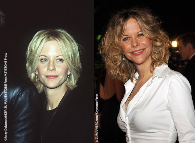 Meg Ryan was a natural beauty who was considered one of the most beautiful women in Hollywood in her prime. As she aged, she underwent a variety of cosmetic procedures that unfortunately did not improve her appearance, but rather changed her for the worse. She went through a period where she almost looked unrecognizable. Her […]