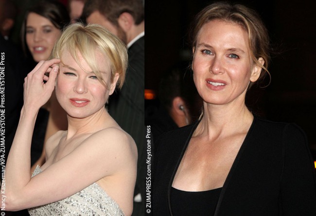 Renee Zellwegger « Celebrity Gossip and Movie News